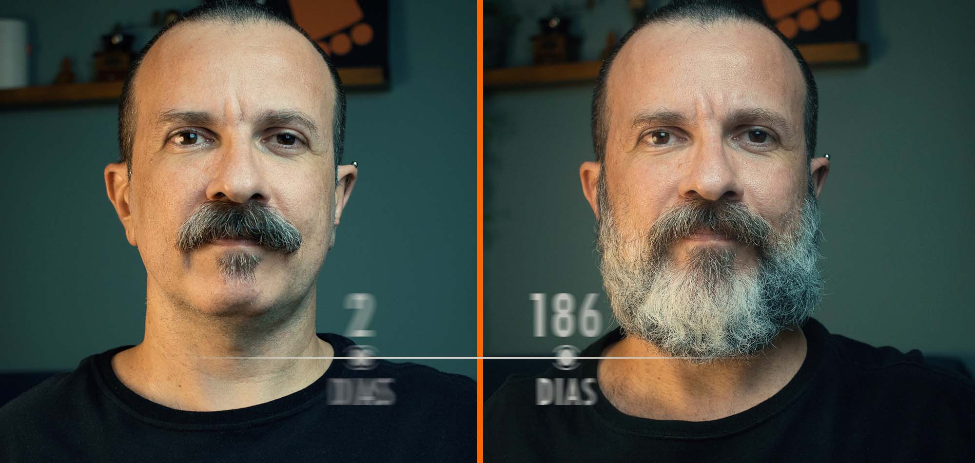 6 Meses Deixando a Barba Crescer | Time-lapse